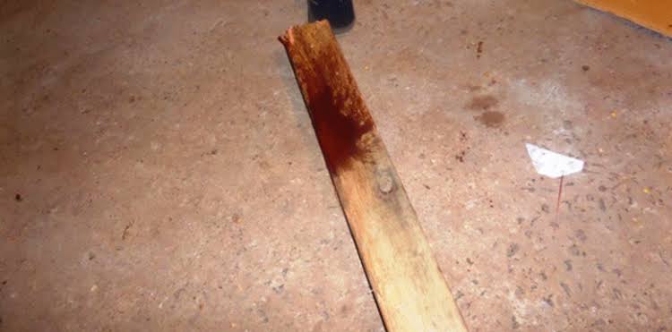 Durante bebedeira com ‘amigo’, homem é espancado e fica em estado grave em Cruzeiro do Sul