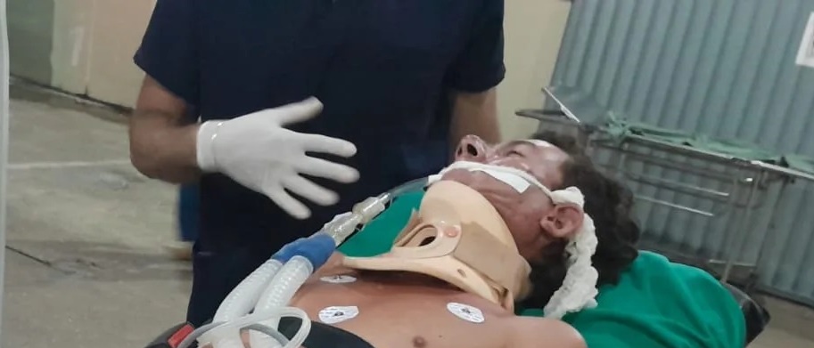 Motociclista sofre acidente e é transferido em estado grave no interior do Acre