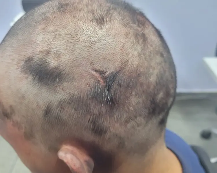 Homem é preso após sequestrar, torturar e raspar cabelo de ex-mulher em motel