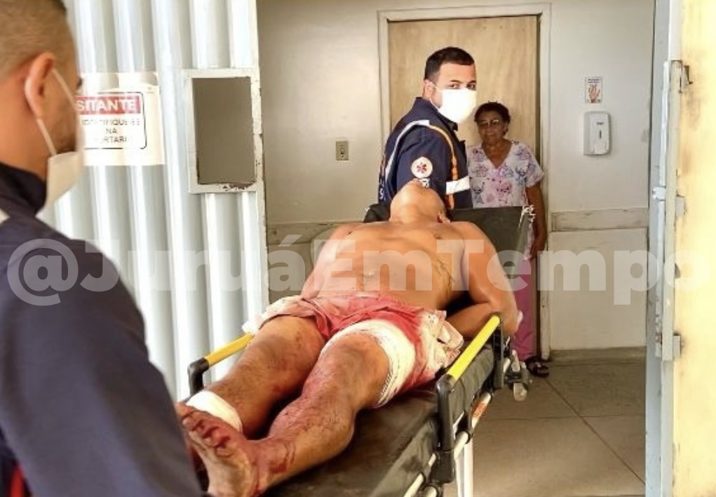 Homem é baleado após tentar agredir policiais durante abordagem na Baixada da Sobral, em Rio Branco