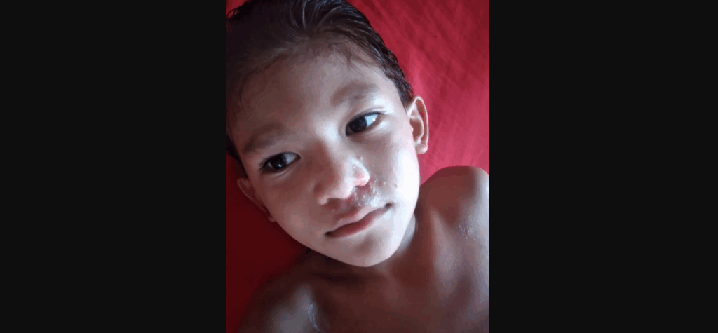 Criança com doença autoimune e transtorno do espectro autista, vive com mais dois irmãos e a mãe com R$700