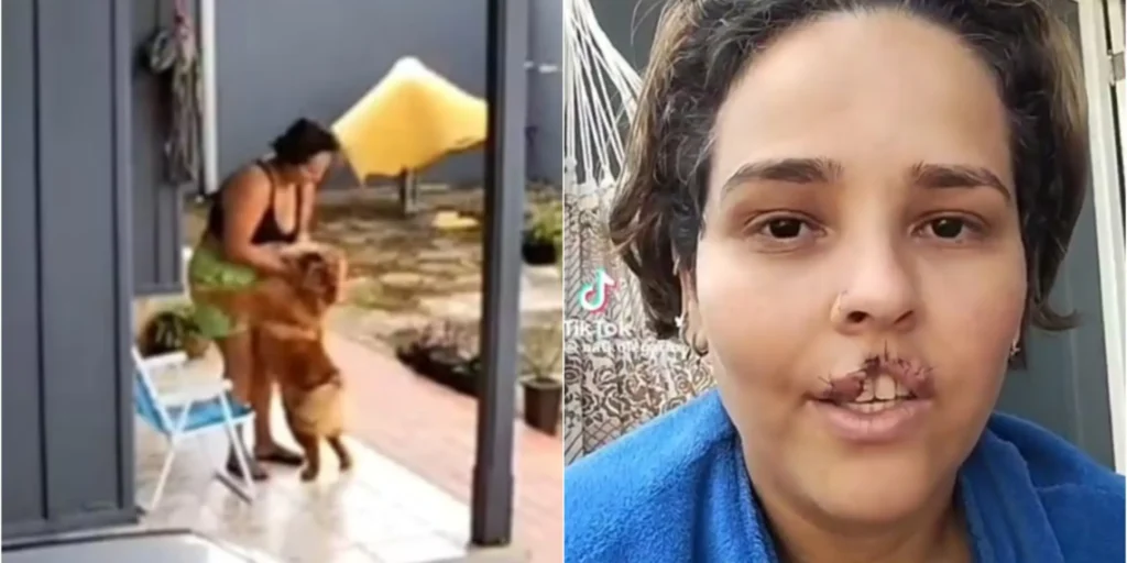 Acreana atacada por cão em Ji-Paraná sofre ameaças nas redes após eutanásia de animal