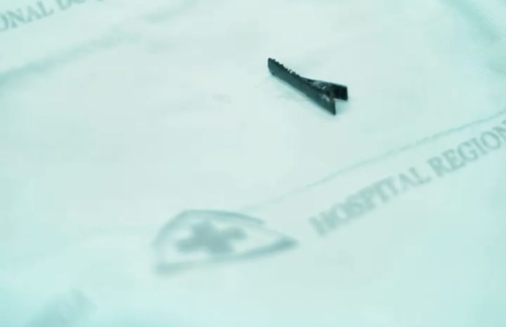 Criança engole presilha de cabelo e é socorrida no Hospital do Juruá