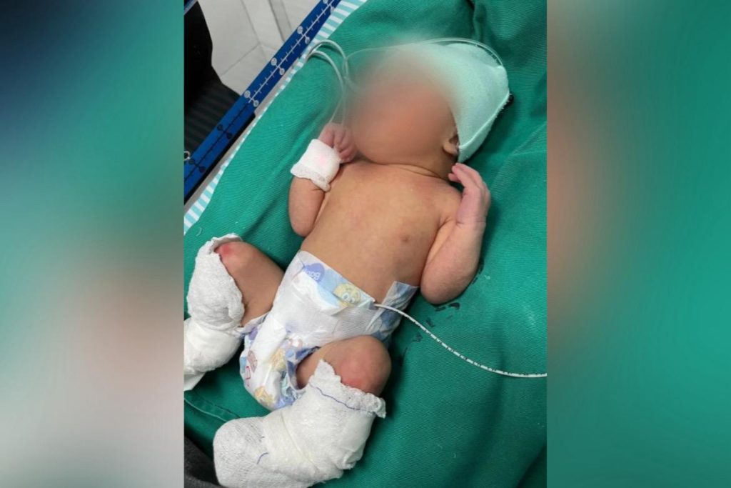 Servidora nega ter sido alertada sobre água quente em banho de bebê na maternidade