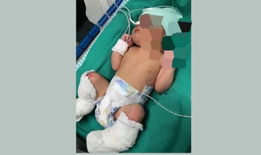 Campanha solidária mobiliza apoio à família de Aurora