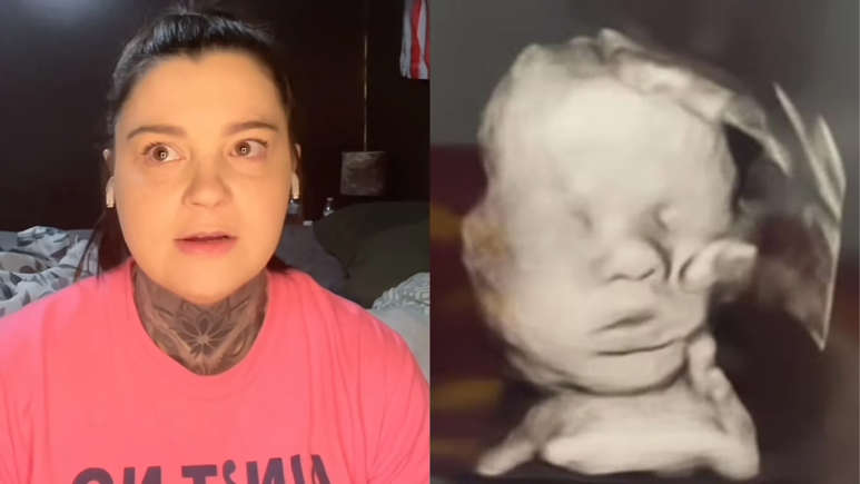 Após orar, mãe diz que ‘mão de Deus’ apareceu em seu ultrassom: “Não sei explicar de outra forma”