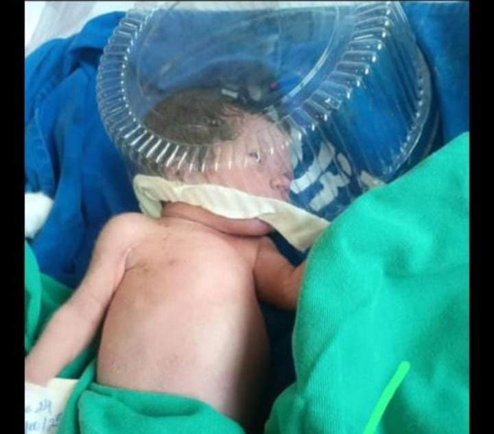 Bebê morre após o parto e família denuncia ‘incubadora improvisada’ no Hospital de Ipixuna (AM)