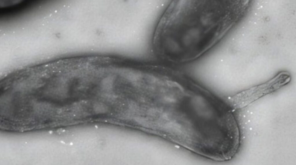 Criança come placa de gonorreia em raro caso de contaminação da doença