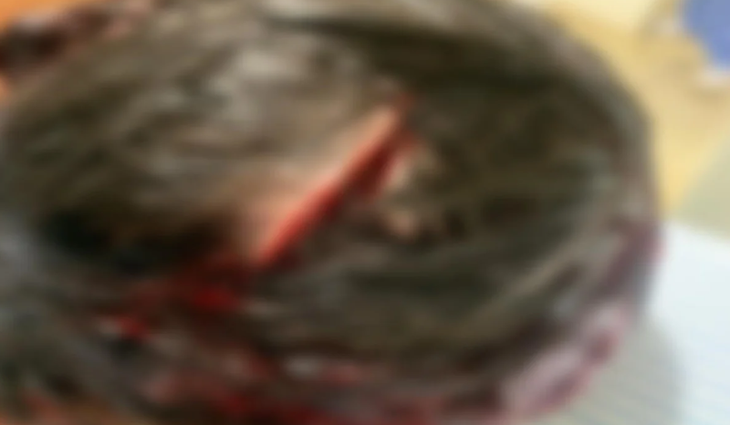 ATAQUE BRUTAL: homem ‘rasga’ cabeça de mulher após ciúmes na festa do filho