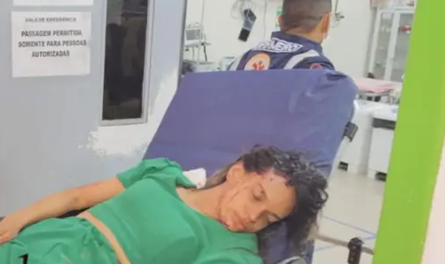 Mulher é atingida na cabeça com tijolo durante bebedeira no Acre