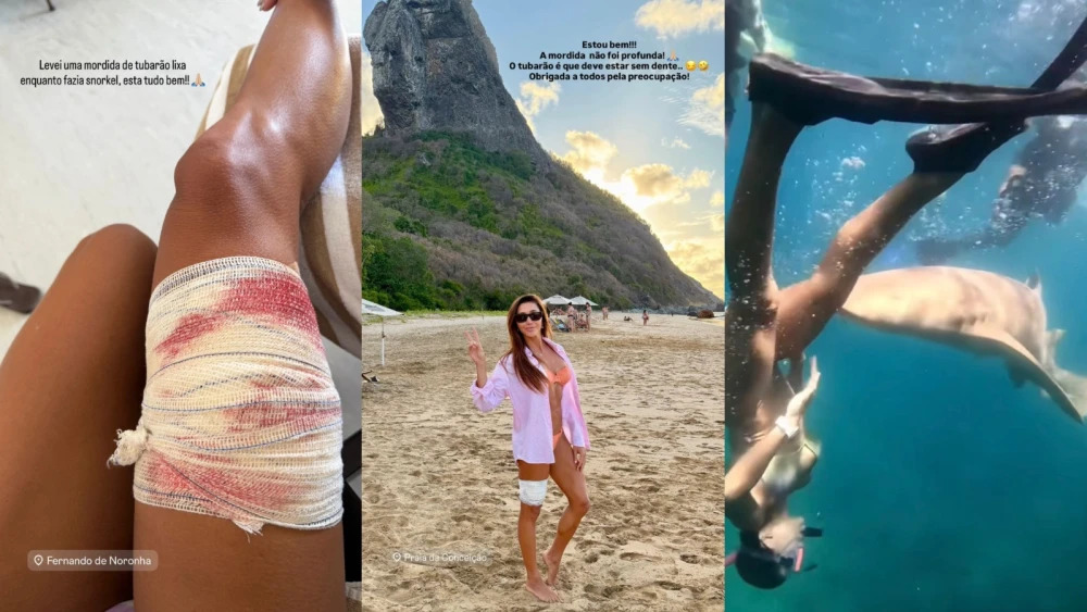 VÍDEOS: advogada é mordida por tubarão em área turística de Fernando de Noronha