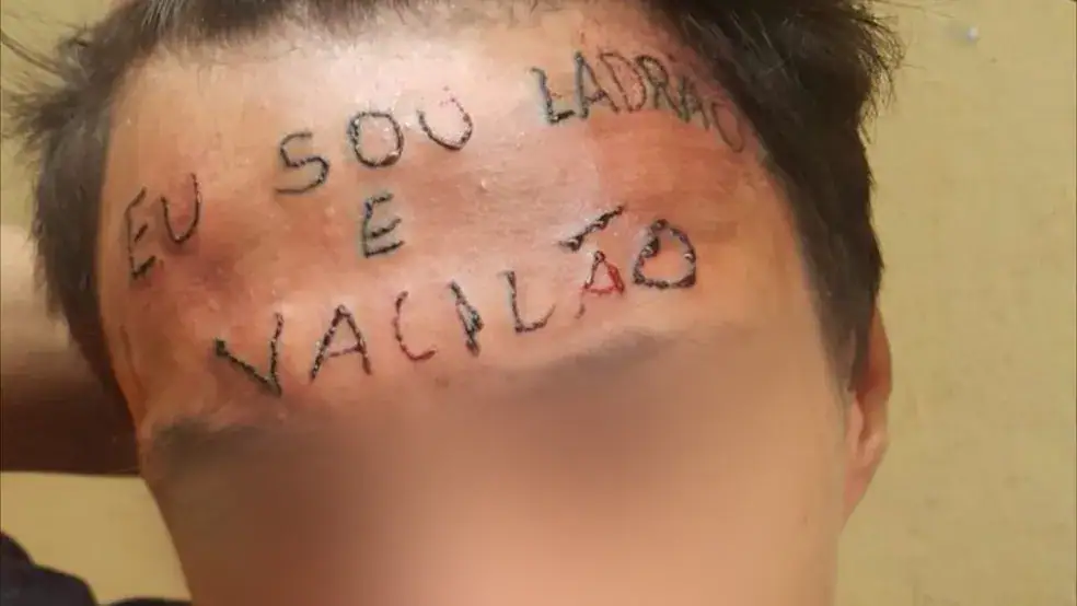 Jovem que teve testa tatuada com frase ‘eu sou ladrão e vacilão’ é preso após furtar unidade de saúde em Diadema