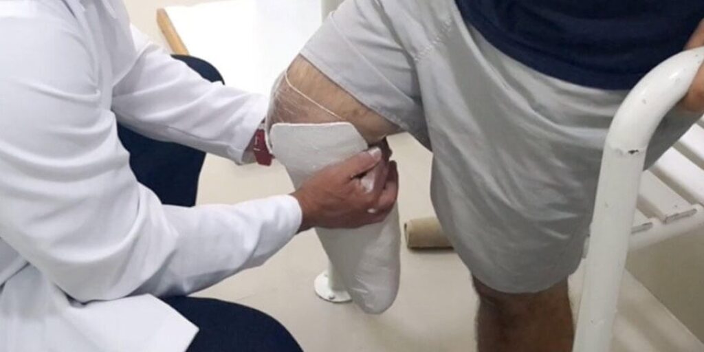 Rio Branco aprova política de prevenção a amputações em pacientes com diabetes