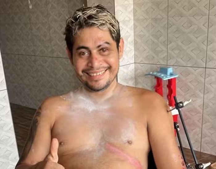 Motociclista que perdeu a perna após acidente passa por dificuldades financeiras no interior do Acre: ‘Situação difícil’
