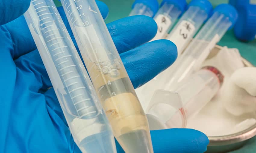 Cruzeiro do Sul confirma caso de meningite bacteriana em criança de 7 anos