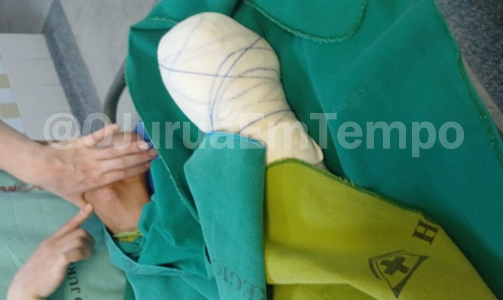 Jovem de 20 anos tem pé amputado após acidente na BR-364; motorista é preso após tentar fugir