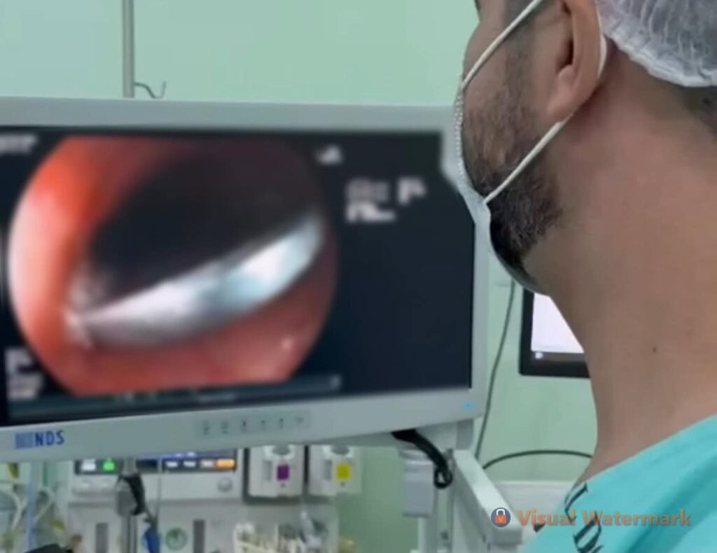 Criança de 3 anos é hospitalizada após engolir moeda em Cruzeiro do Sul; veja vídeo