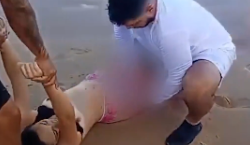 Vídeo mostra resgate de jovem após perna ser arrancada por tubarão